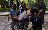 A wounded University of PNG student.